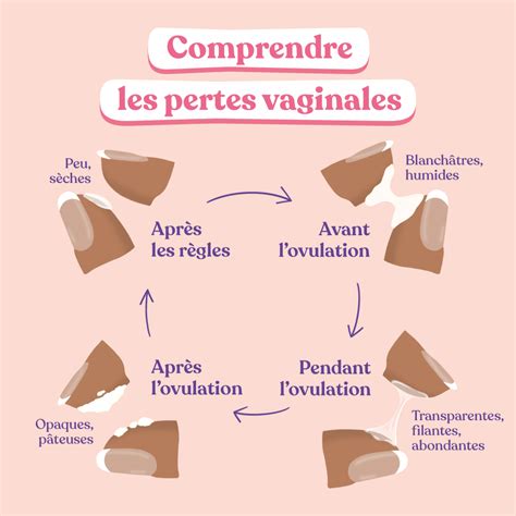 perte blanche cremeuse|Pertes vaginales blanches, quand sinquiéter et quand。